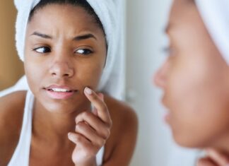 Comment ne plus avoir de boutons ? Problèmes de peau