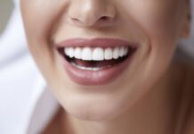 Comment avoir les dents blanches ? Dents blanches femme