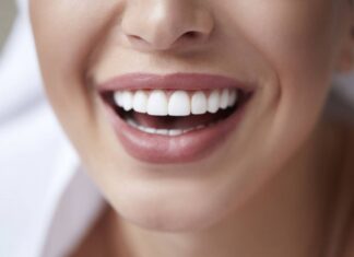 Comment avoir les dents blanches ? Dents blanches femme